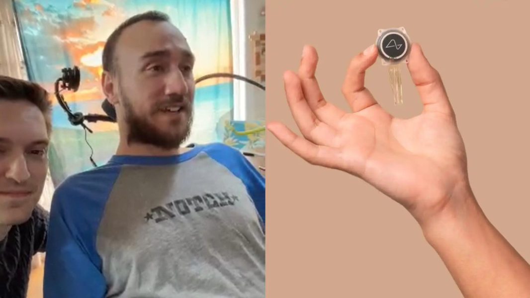 841676010_240908411_1706x960